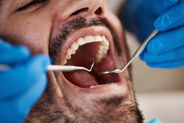 Best Emergency Treatment for Toothache in Broad Brook, CT