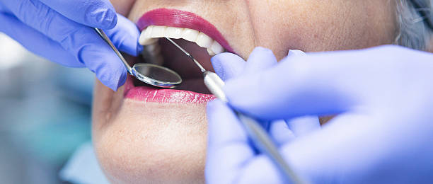 Best Emergency Dental Care for Trauma or Injury in Broad Brook, CT